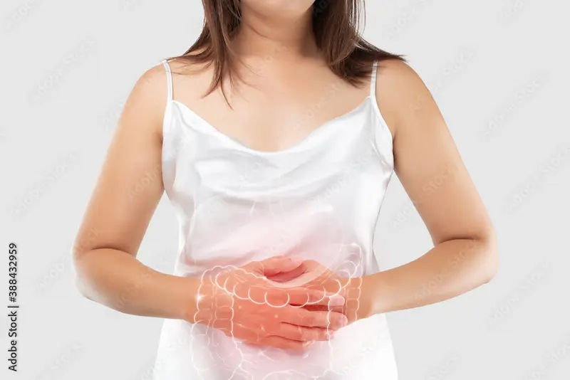 Ulcerative Colitis Overview and Considerations